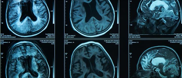 Give UC Davis - David L. Weaver Award